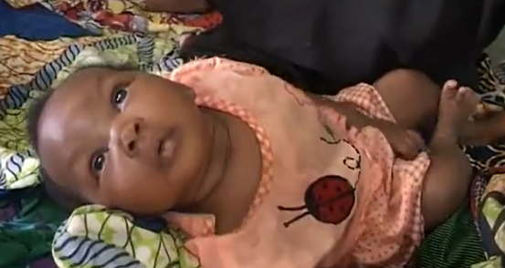 非洲醫院做手術，醫生就到點直接下班了