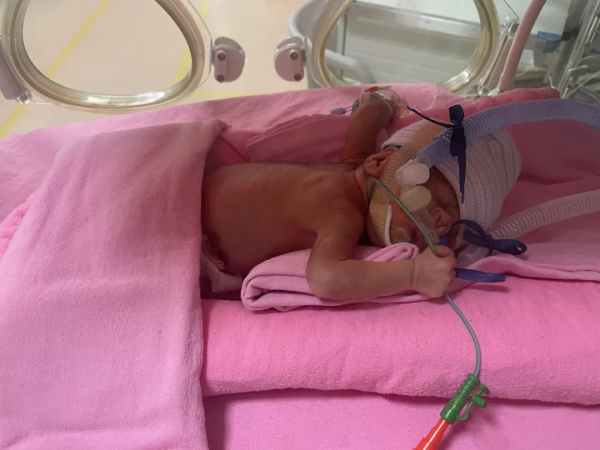 “我的孩子在新加坡早產,只有1kg重!面臨35萬天價賬單......” “我的孩子在新加坡早產,只有1kg重!面臨35萬天價賬單......”