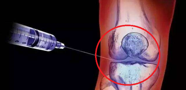 封閉針，究竟是“毒”還是“藥”？聽聽醫生怎麼說