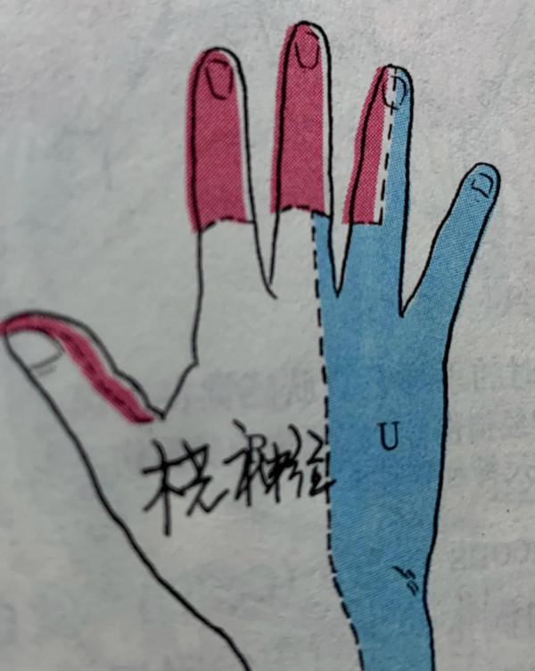 手指麻木之橈神經淺支卡壓綜合徵