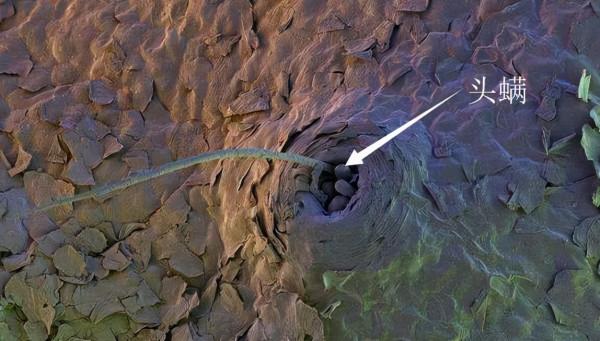 頭蟎是什麼?頭皮上也有蟎蟲 頭蟎是什麼?頭皮上也有蟎蟲