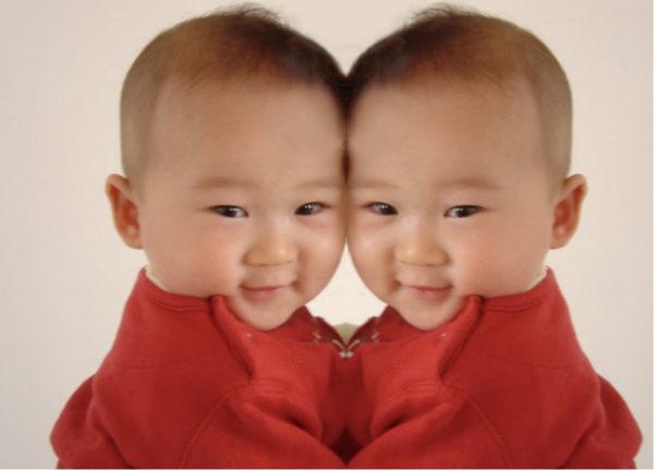 兩個大腦指揮一個身軀,真的能保證不吵架嗎?連體嬰生活大揭秘 兩個大腦指揮一個身軀,真的能保證不吵架嗎?連體嬰生活大揭秘