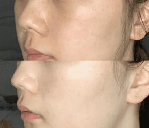 建議大家：逛超市的時候，遇到這3個老牌“萬能霜”，別錯過