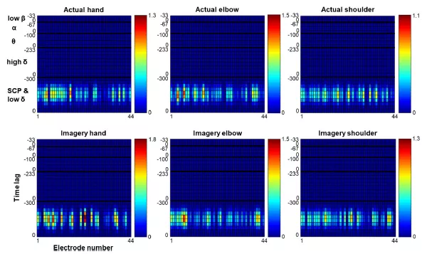 用腦電圖慢皮層電位重建3D空間中的手,肘和肩的實際和想象的軌跡 用腦電圖慢皮層電位重建3D空間中的手,肘和肩的實際和想象的軌跡