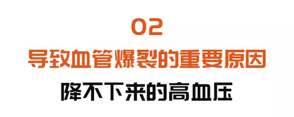 血管&OpenCurlyDoubleQuote;爆裂&rdquo;之前，可能會有這些症狀！自測方法也別錯過