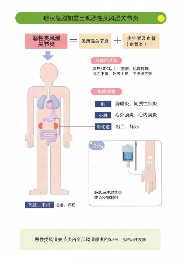 類風溼患者多久該複診?複診應關注哪些專案和指標? 類風溼患者多久該複診?複診應關注哪些專案和指標?
