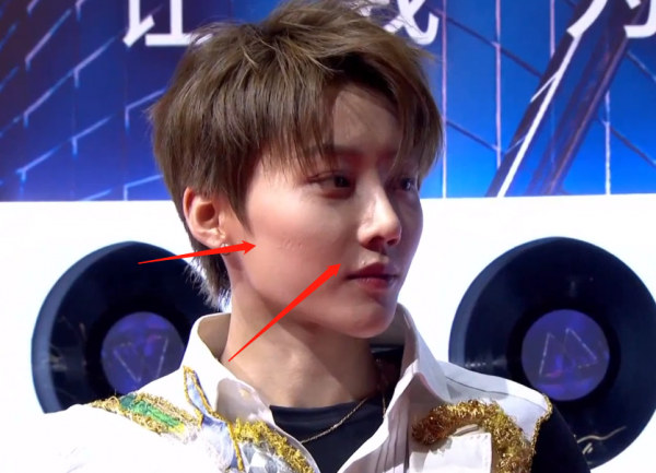 又見紅毯魔鬼打光！明星一臉坑窪，粉底又厚又白好像戴了面具