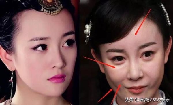 別無效整容了，看看這些曇花一現的女星，整前是仙女，整後變蔡明