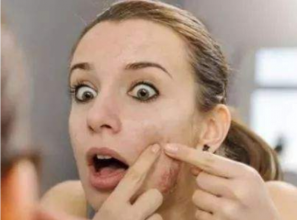 痘痘、口臭、油光、體內溼熱重？中醫二味中藥的攻破法，請你學習