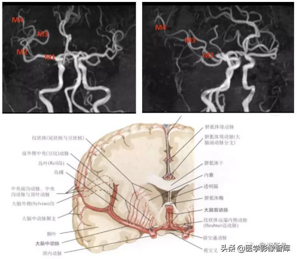 CT斷層解剖圖譜最全總結「推薦收藏」 CT斷層解剖圖譜最全總結「推薦收藏」