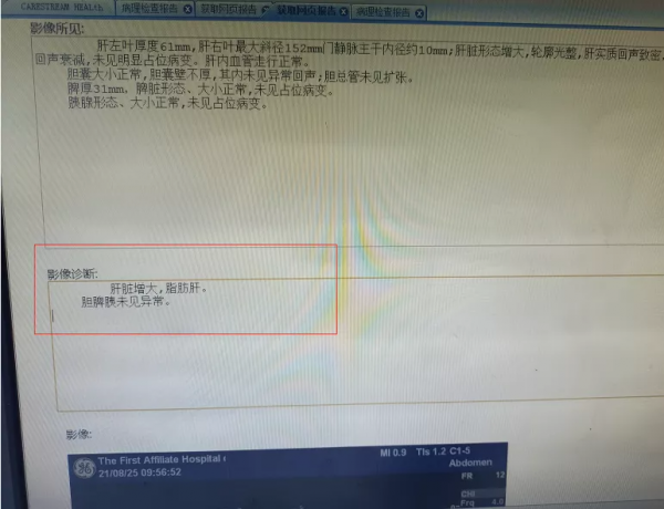 刷遍王存川教授抖音,實現S碼穿衣夢想 刷遍王存川教授抖音,實現S碼穿衣夢想