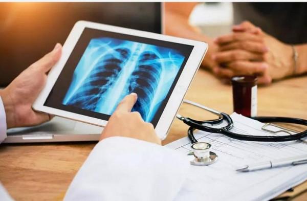 肺癌專家喊你鍛鍊心肺：每週至少做150分鐘中等強度運動