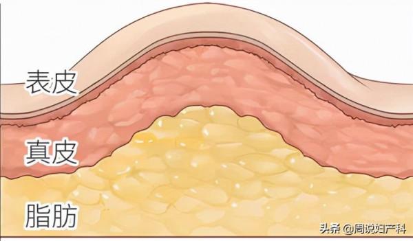 不胖卻有小肚子，當心這3個問題
