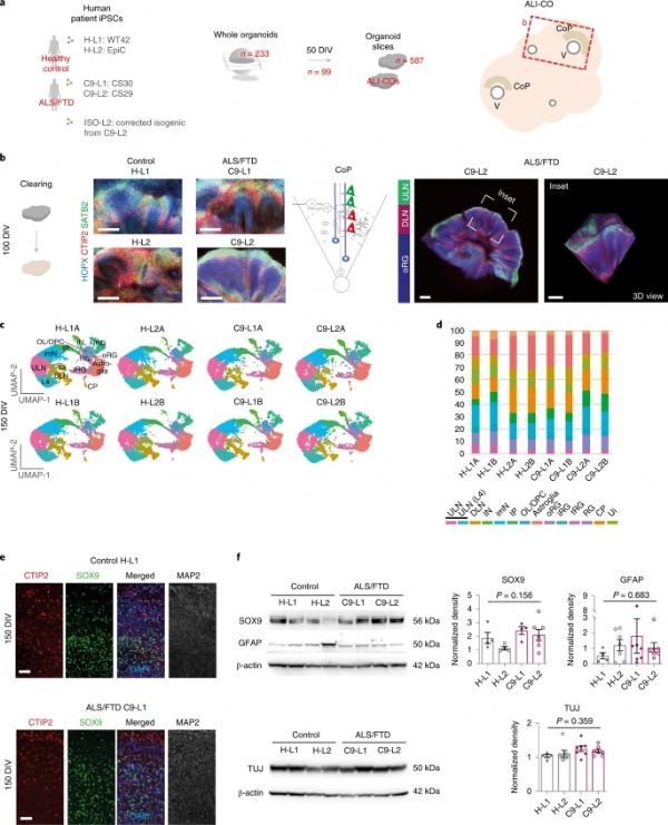 科學家利用類器官切片揭示神經退行性疾病早期神經病理學特徵