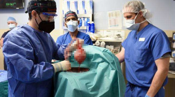 又一里程碑！57歲男子接受豬心臟移植，醫生：暫無免疫排斥反應