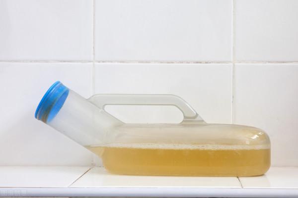 糖尿病出現泡沫尿一定是腎臟受損?假的!做好4個要點保護腎 糖尿病出現泡沫尿一定是腎臟受損?假的!做好4個要點保護腎