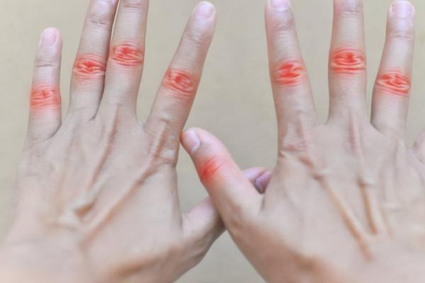 手指疼痛,原因多是這4個,若病情反覆,及早對因治療 手指疼痛,原因多是這4個,若病情反覆,及早對因治療