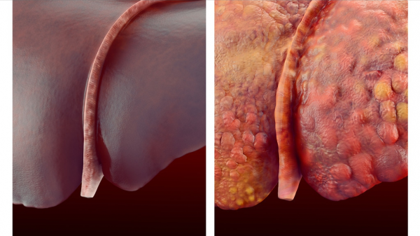 肝功能檢查單怎麼看？醫生：這3個指標正常，說明你的肝臟很健康