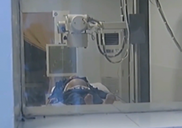 真實故事:91歲老太離奇懷孕,B超檢查胎兒骨骼清晰可見,最後怎樣了