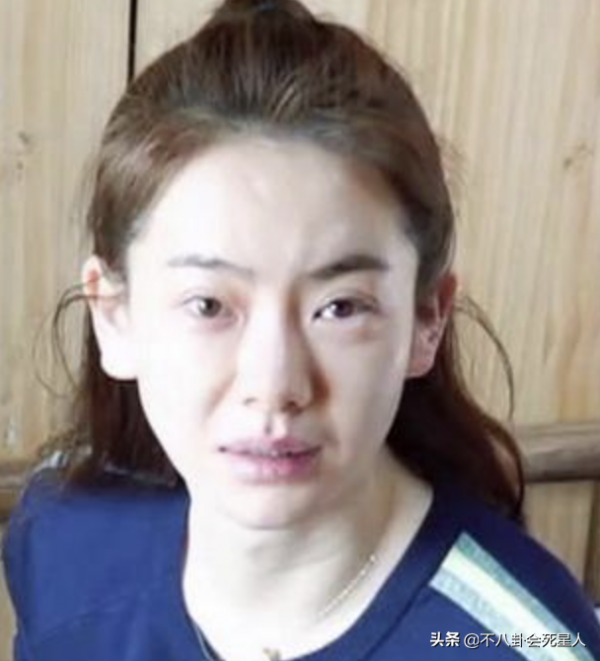 31位女星素顏名場面！浮腫油膩、憔悴老態，還暴露動臉痕跡