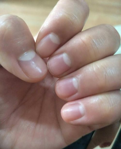 孩子指甲一天一個樣?瞭解這些才能科學成長 孩子指甲一天一個樣?瞭解這些才能科學成長