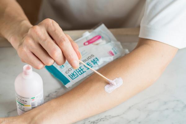 蕁麻疹瘙癢難耐 夜不能寐！中醫面板科醫生教你4個方法快速止癢