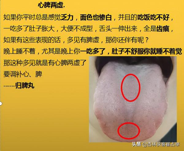 治療失眠的中成藥大總結,失眠、多夢、入睡困難再也不怕用錯藥 治療失眠的中成藥大總結,失眠、多夢、入睡困難再也不怕用錯藥