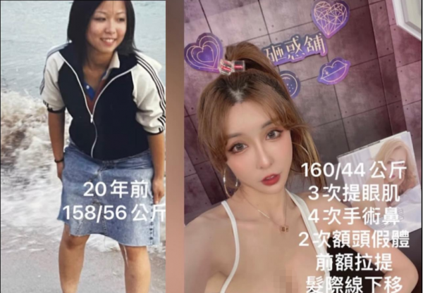 整形11次！網紅“雪碧”20年前對比照曝光，網友：根本不是一個人