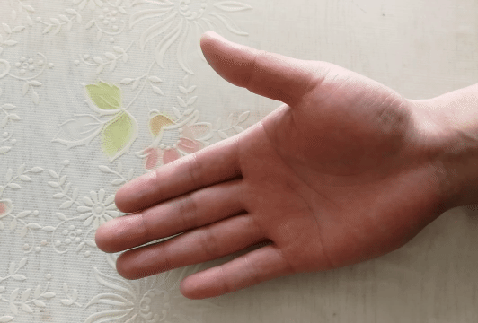 50歲左右的中老年人，手指僵硬、疼痛、怕冷、變形，預示哪些疾病