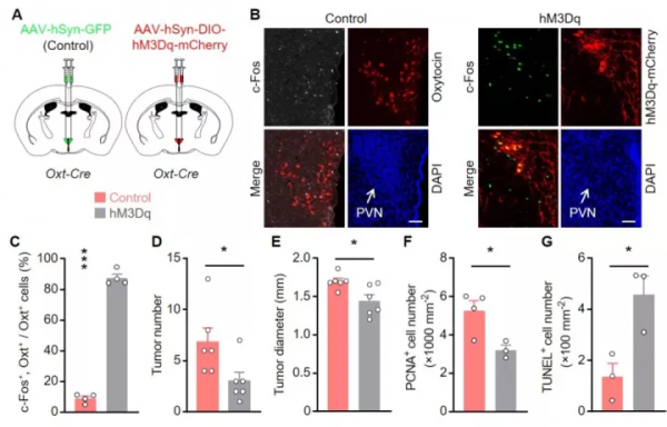 腦科學日報：年紀輕輕就中風了？青年卒中不容忽視