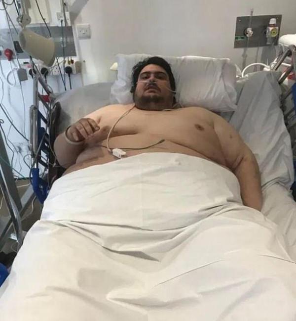 英國最胖男子體重達634斤,曾為了出門動用起重機從窗戶吊出來 英國最胖男子體重達634斤,曾為了出門動用起重機從窗戶吊出來