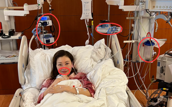 老戲骨重出江湖是個錯？張敏演技被罵尷尬，李嘉欣住ICU被嘲活該