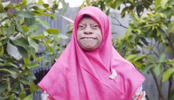 男子一家人患怪病，長得像動物，至今沒有治療方法