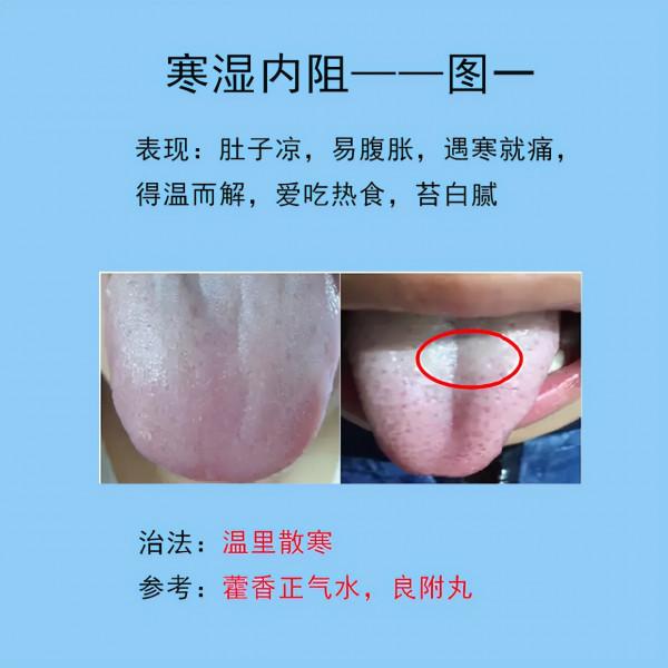脾胃常見的10種舌象,以及臨床表現,後面帶解決方法 脾胃常見的10種舌象,以及臨床表現,後面帶解決方法