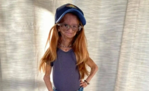 知名網紅阿達莉亞·羅斯因早衰症去世，年僅15歲，家人公佈死訊