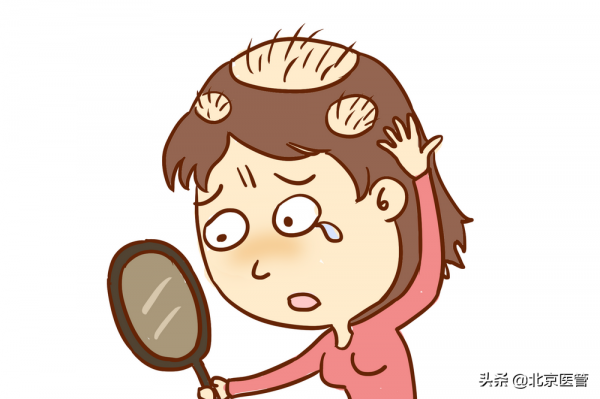 斑禿找上門了！怎麼治？