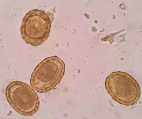 ​幾十年前男女老少體內，幾乎都長蛟蛕，為何現今很少聽說了？