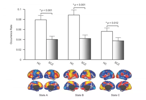 Nature子刊:劉河生教授發現精神疾病患者腦活動的核心紊亂z Nature子刊:劉河生教授發現精神疾病患者腦活動的核心紊亂z