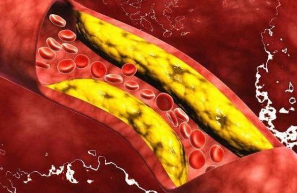 堅持走路能保護血管？提醒：45歲後的人，保護血管需做好這5件事