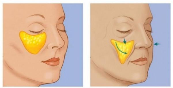 從賈玲到宋丹丹，為啥成為喜劇演員後，她們的顏值會直線下滑？