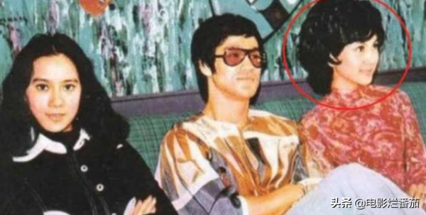 8位女星的整容“塌房路”：有人葬送事業，有人毀容，張檬可惜了