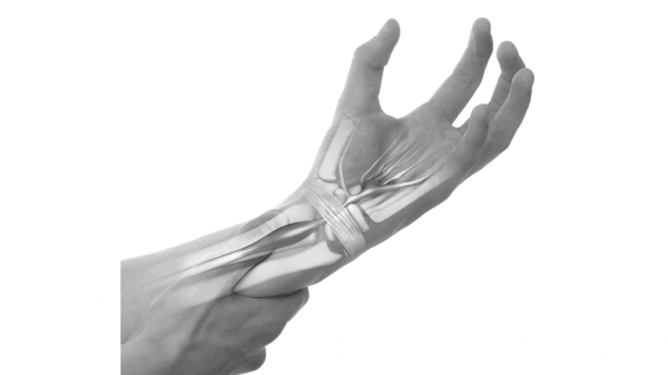 練瑜伽，千萬不要忽視腕部安全