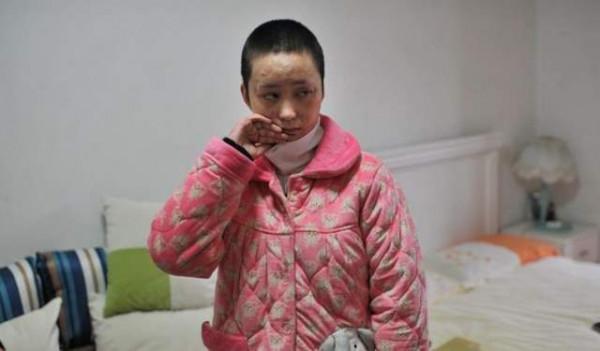 十年前，因拒絕官二代追求，被潑汽油燒至毀容的女孩，你還好嗎？