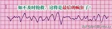 這樣教你看心電圖,沒有理由看不懂 這樣教你看心電圖,沒有理由看不懂