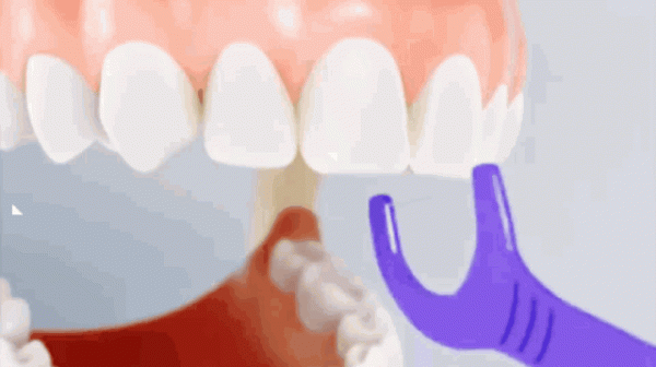 孩子牙齒又黃又黑，天天刷牙還長齲齒，醫生教你正確護牙方法