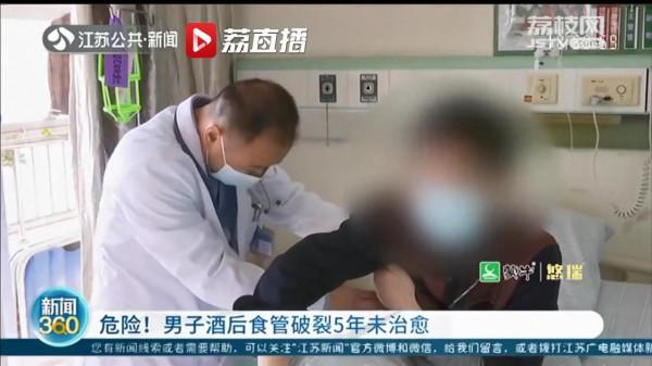 危險！男子酒後食管破裂5年未治癒 猶如“定時炸彈”