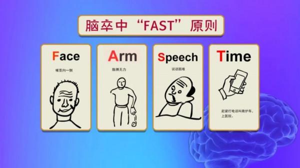 識別腦中風先兆,學會重要急救步驟,關鍵時刻真的能救命!——“323”系列科普 識別腦中風先兆,學會重要急救步驟,關鍵時刻真的能救命!——“323”系列科普