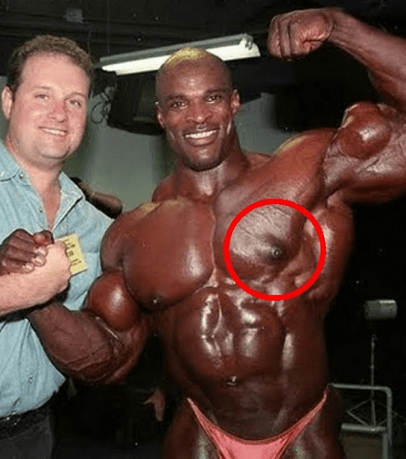 7位頂尖健美運動員,承認在健美生涯中使用過類固醇 7位頂尖健美運動員,承認在健美生涯中使用過類固醇