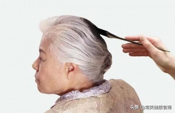 一粒一粒,一片一片,一塊一塊,頭皮上究竟能長出多少“髒東西” 一粒一粒,一片一片,一塊一塊,頭皮上究竟能長出多少“髒東西”