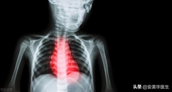 胸悶是什麼病？